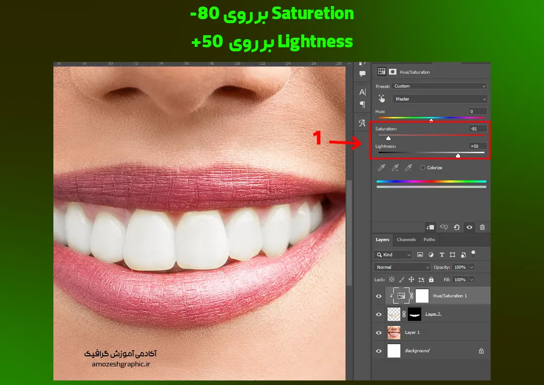 تنظیمات Hue/Saturation  برای سفید کردن دندان