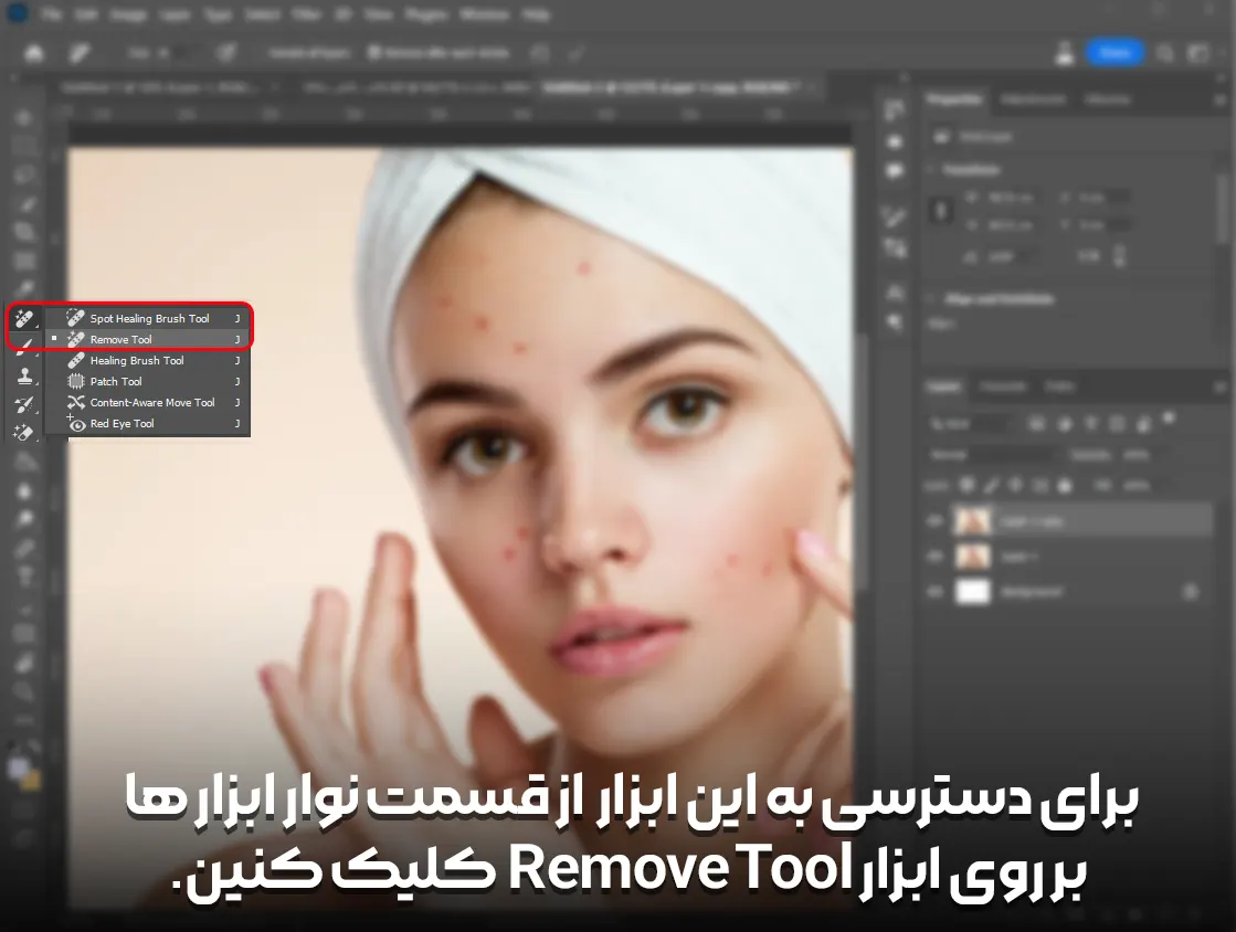 ابزار Remove Tool